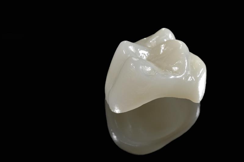 Dental Crown in Santa Rosa